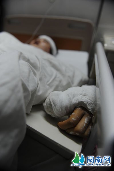疑情人跟人跑了 安溪暴力男砍断其双手手筋
