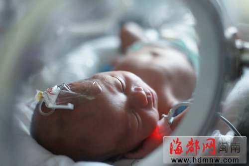 重病孕妇产双胞胎后辞世 留遗言保住孩子