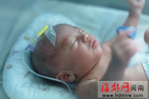 重病孕妇产双胞胎后辞世 留遗言保住孩子