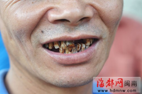 安溪光德“黑牙村”探秘